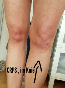 Februar 2017 Ansicht von vorne